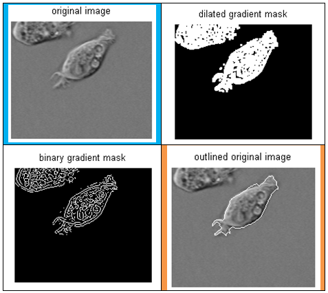 Cell Detection using Image Segmentation using MATLAB